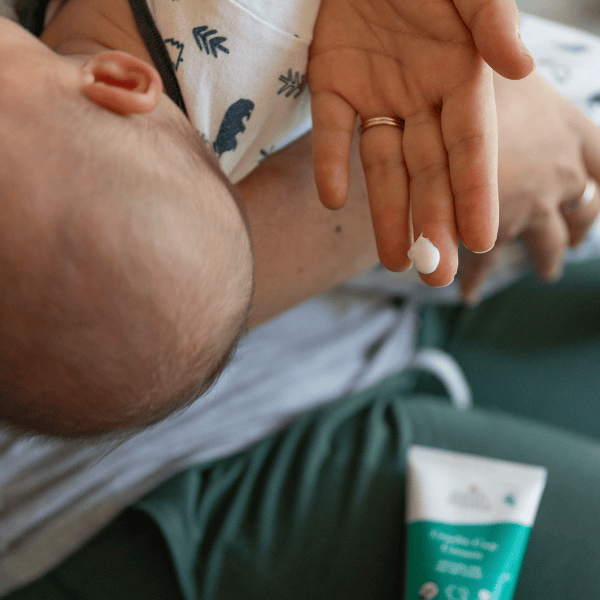 Earth Mama - Cradle Cap Cream Natural Toiletries Earth Mama Organics